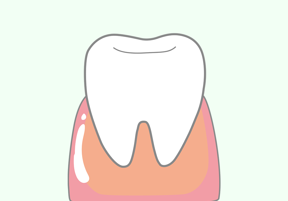 健康的な歯ぐき