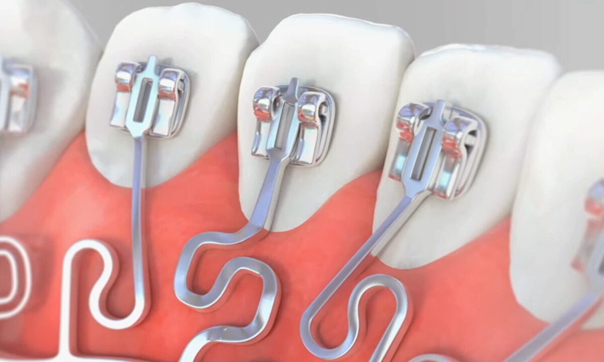 ブラーバのイメージ