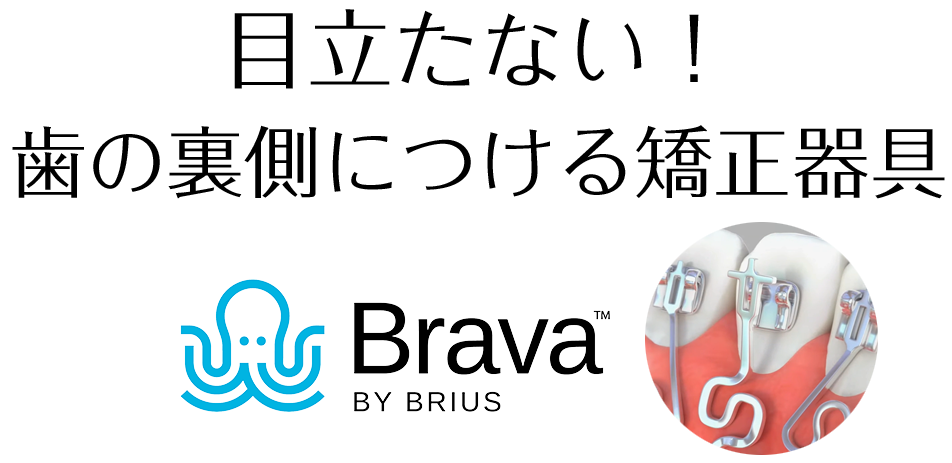 歯の裏側につける矯正器具ブラーバ