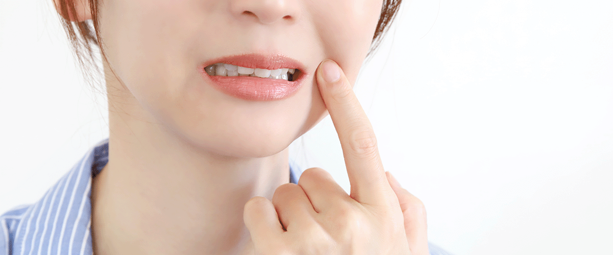歯が気になる女性
